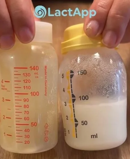Understanding Breast Milk Management: Key Insights